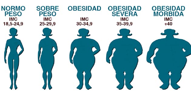 Obesidad ¿que Es La Obesidad